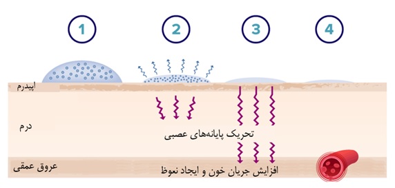 مکانیسم اثر ژل ایجکسن